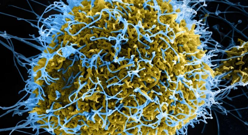 Ígéretes eredményeket mutat az ebola legveszélyesebb vírustörzseire fejlesztett vakcina