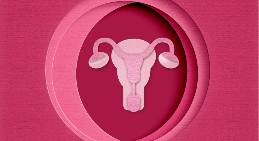 Új neve lett a PCOS-nek – miért kellett átnevezni a betegséget?