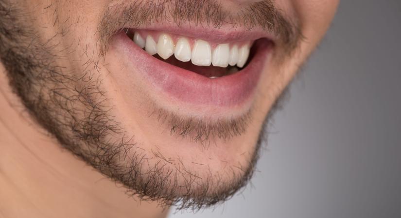 Szerbiában 700 ezer embernek nincs saját foga, 65 év felett a lakosság 40 százalékának nincs foga