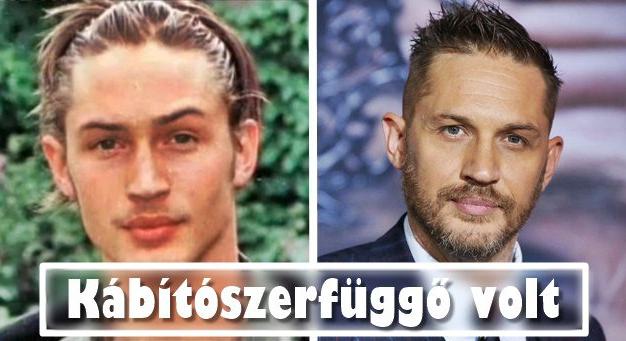 10 híres színész, aki szívesen eltitkolná a múltját
