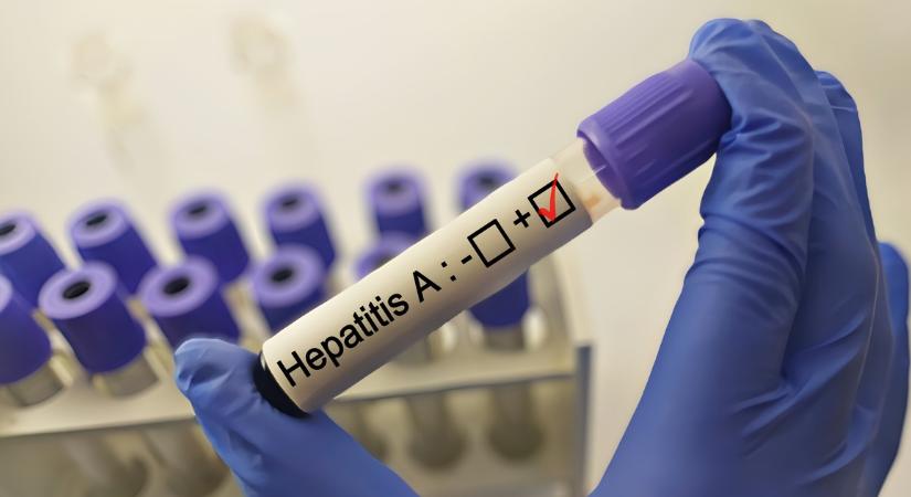 Karanténba zártak egy balmazújvárosi óvodás csoportot a Hepatitis A-vírus miatt