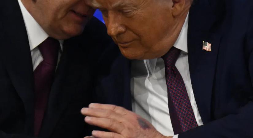 Donald Trump hivatalosan makkegészséges, de az orvosi vizsgálat eredményei több kérdést is felvetnek