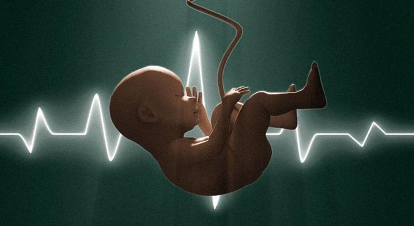 Szívhangrendelet – Mit gondolna, mit mondana, mit tenne Jézus?