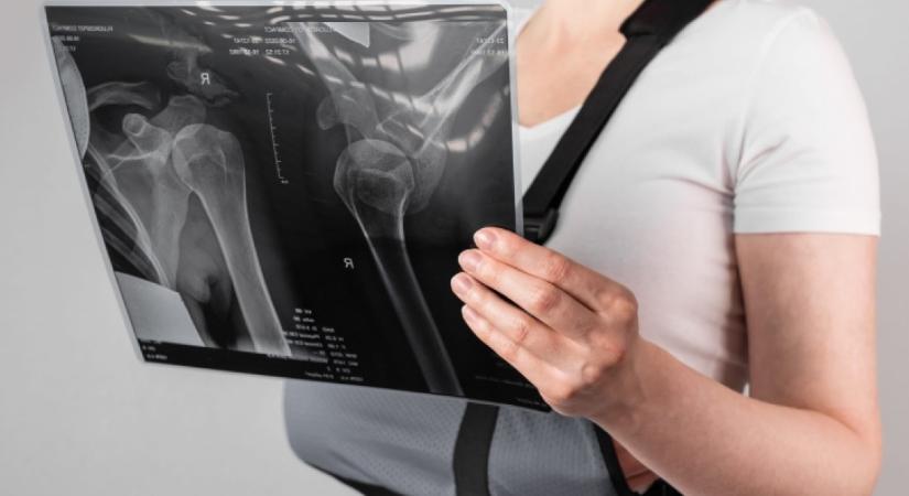 Búcsúzz el tőlük: ez a 3 étel durván károsíthatja a csontjaidat