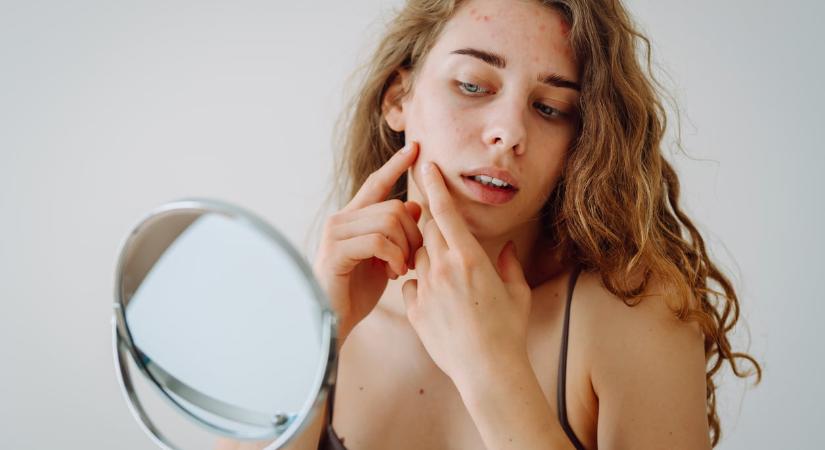 Pattanások, szárazság, ragyogás: így változik a bőröd a menstruációs ciklusod során