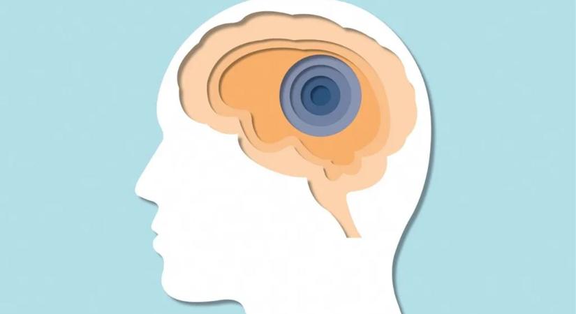 Vége a stroke-nak? Úgy tűnik, megvan az áttörés