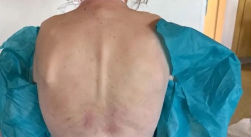 Ápolók bántalmazhattak egy mozgáskorlátozott beteget a Jahn Ferenc Dél-pesti Kórházban, a rendőrség nyomoz