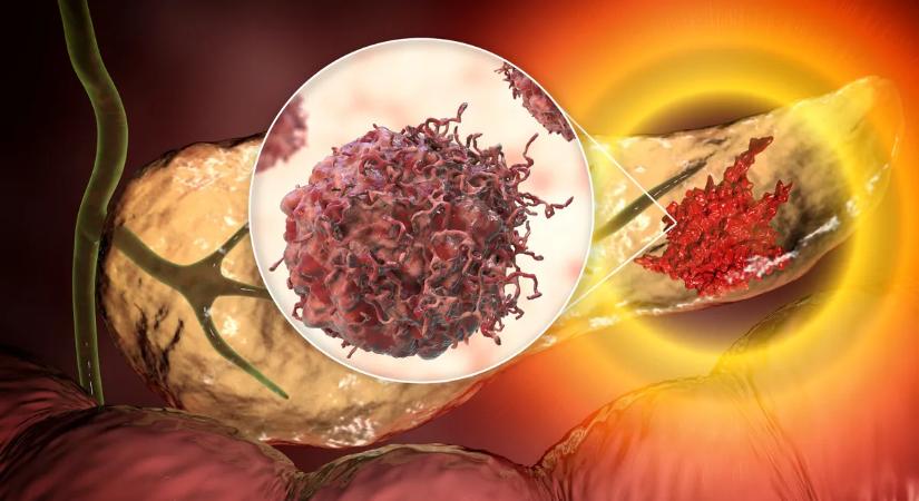 Áttörheti a rákos sejtek védvonalát az egyik kedvelt vitamin