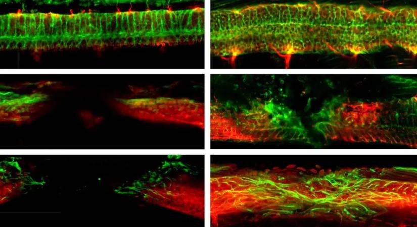 Apró nanorobotok hozhatnak áttörést a gerincsérülések kezelésében
