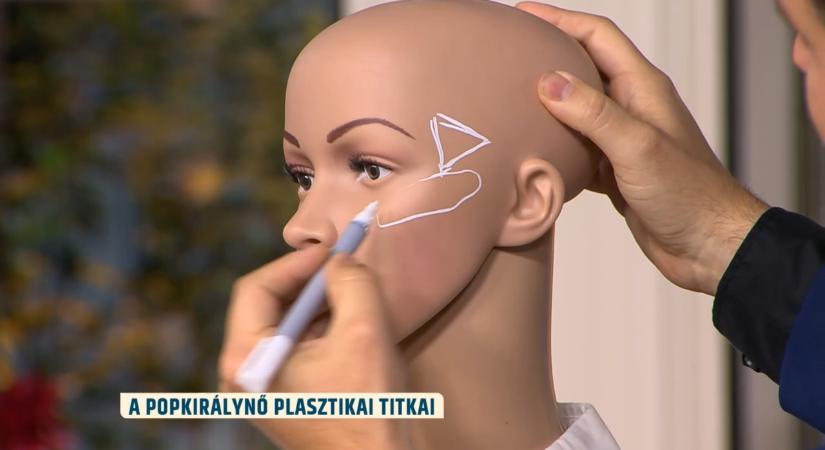„Madonna megtesz mindent, hogy fitt maradjon” – Botox, sajátzsír-feltöltés és arcfelvarrás?