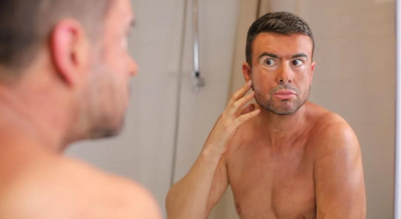 Így néz ki a férfi, aki bebarnult egy gyógyszertől