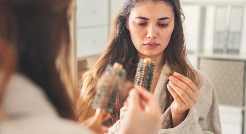 Ezek a hajhullás okai: vitaminhiány és hormonprobléma is állhat a háttérben
