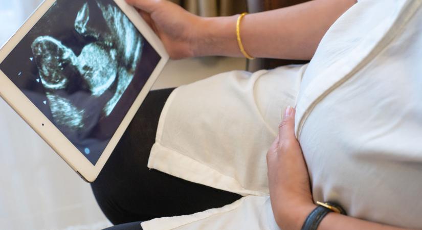 Újabb túlárazott biznisz derült ki: aranyáron vették az állami meddőségi klinikák szoftvereit