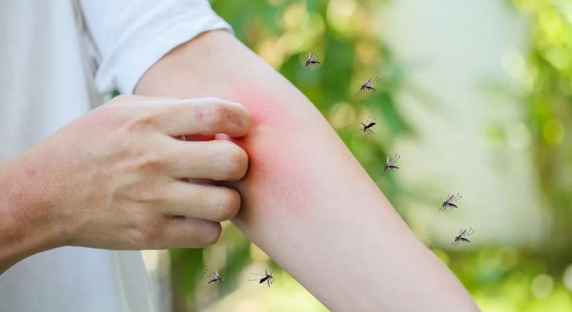 Tudatosan választják ki az áldozatukat? Eláruljuk, miért téged csípnek szét mindig a vérszívók