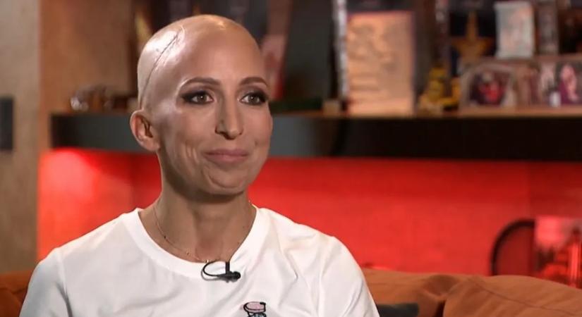 "Még nem vagyok a régi, de jó úton haladok" - így telt Rubint Réka első napja otthon a kórházból való hazatérés után