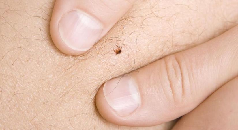 Pánik a csípés után: mutatjuk a leggyakoribb hibákat a kullancs kiszedésekor