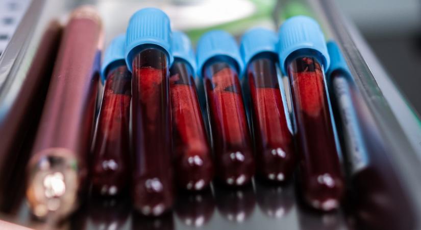 Szívszorító közlemény: Életmentő műtét előtt áll a magyar focilegenda, azonnal vérre van szüksége