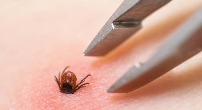 Kullancscsípés után erre a tünetre figyelj: Lyme-kórt jelezhet