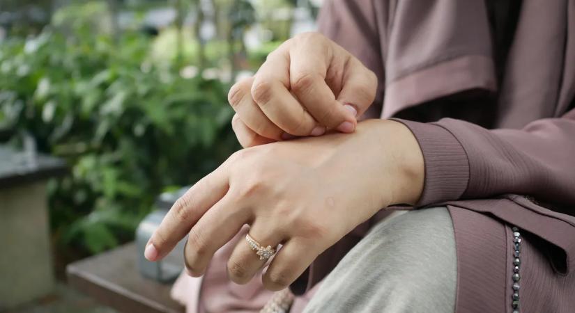 „Lehámlott a bőre a fürdőkádban” – anyukája ritka betegségét hordozza a fiú