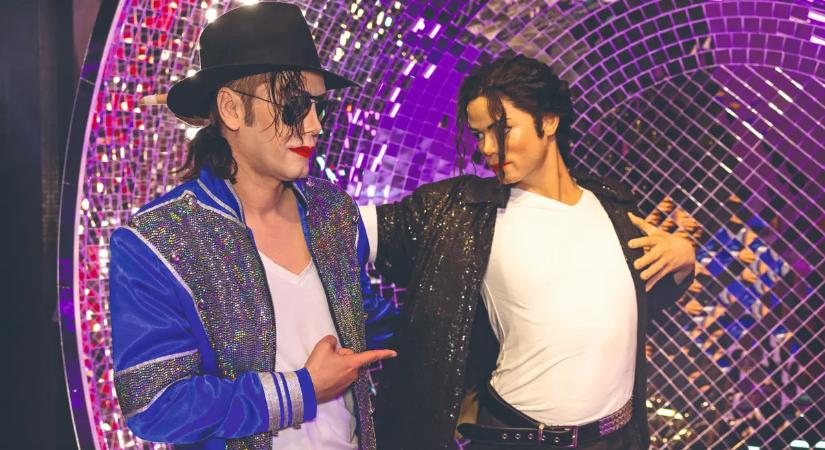 A magyar Michael Jackson: „Ugyanaz vagyok, aki a műtétek előtt voltam”