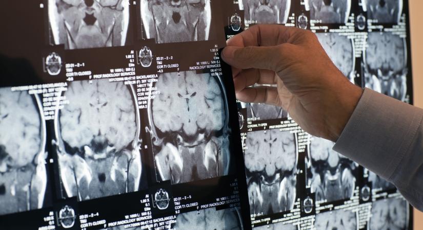 Megfejtették a kutatók: ez a titokzatos anyag felelős azért, ha képtelenek vagyunk változtatni a szokásainkon