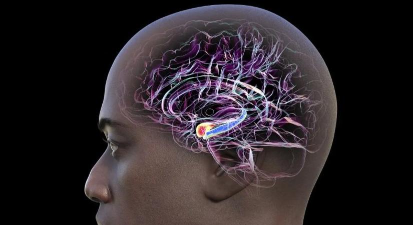 Tragédia: ő a legfiatalabb, akit valaha Alzheimer-kórral diagnosztizáltak