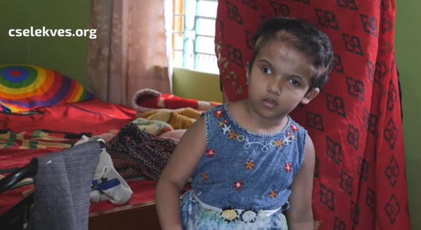 Magyar orvosi csoda hét év után: így élnek ma a szétválasztott bangladesi ikerlányok
