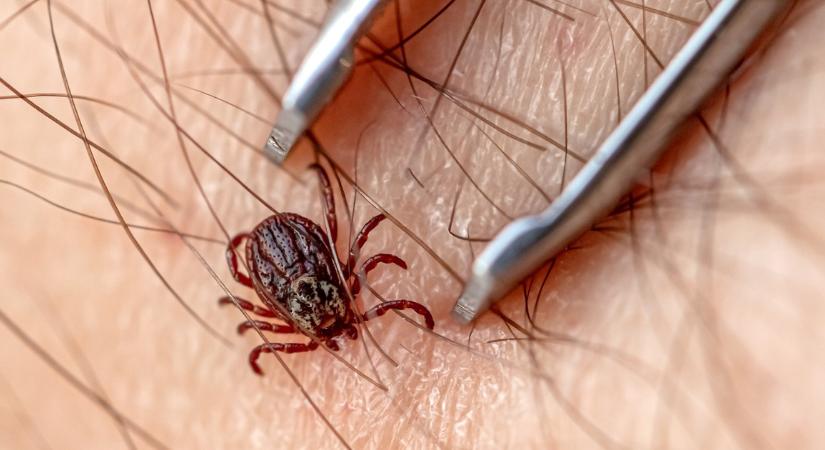 Itt a tuti módszer, amivel kullancsmentes zónává alakíthatja a kertet