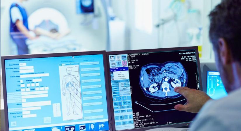 A legtöbb infarktus és stroke előtt ez történik – több mint 2 millió ember adatait vizsgálták