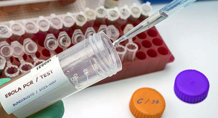 Mit kell tudni az Ebola-vírusról?