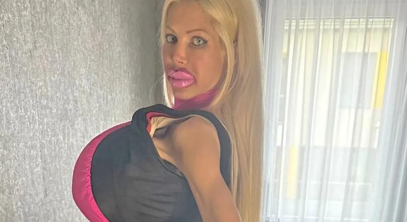 Ismét megműttette melleit Baj Angelika? Brutális fotó!