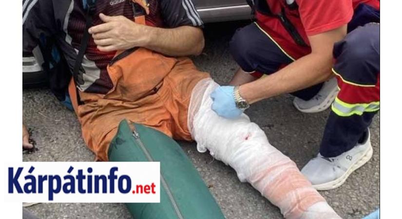 Súlyos baleset Huszton: rolleres ütközött autóval