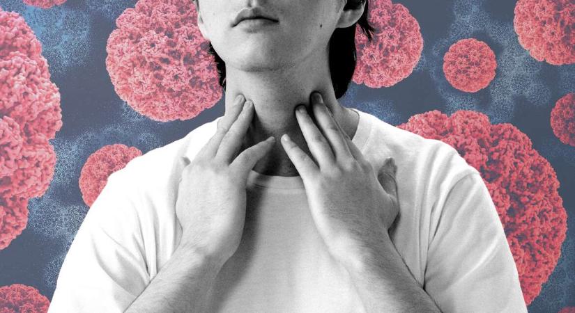 A HPV nem csak méhnyakrákot, a dohányzás nem csak tüdőrákot okozhat – figyelmeztetnek a szakemberek
