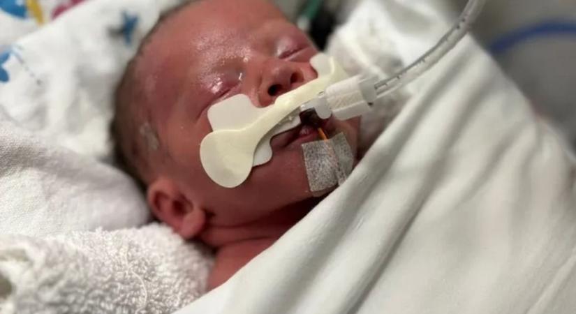 „Nem gondolod, hogy beteg gyereked lesz, aztán mégis ez történik” - Ritka genetikai betegséget élt túl egy kisbaba