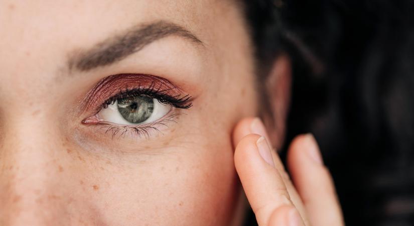 Az arcod is megmutatja, ha vitaminhiányod van: ezt az 5 tünetet ne vedd félvállról