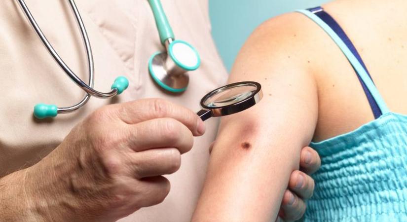 Rákot is jelezhet: ha ezt látod a bőrödön, azonnal fordulj orvoshoz