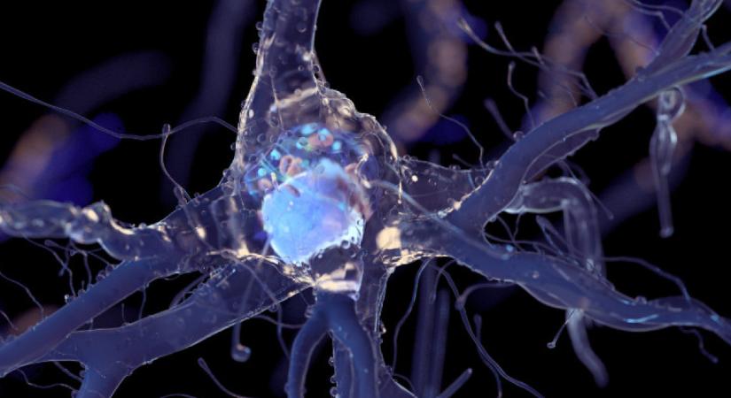 Jobb, ha felkészülsz? Közel egymillió ember adataiból derült ki a 3 rendellenesség, ami mögött az Alzheimer bújkál