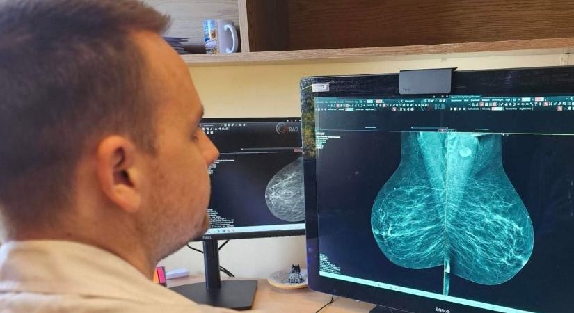 A szűrővizsgálat életet menthet, a záhonyi hölgyeknek nem kell egyedül utazniuk