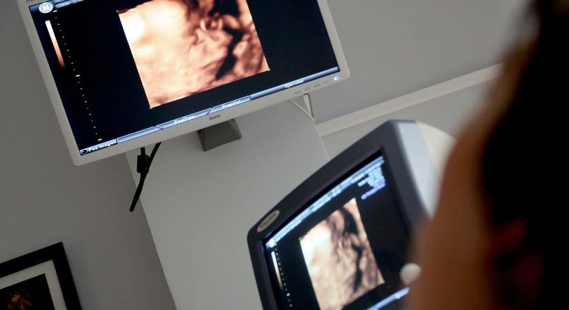 Milliónál is több terhességmegszakítás: postai úton érkezik az abortusztabletta az életvédő államokba