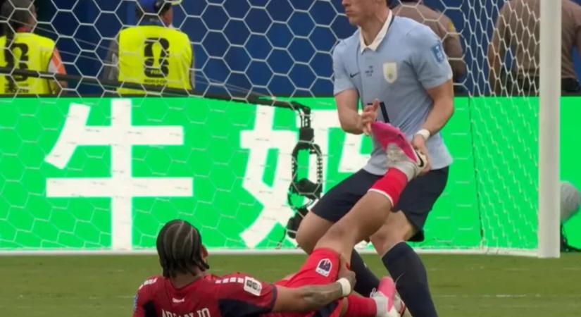 A zöld-fokiak edzője felhúzta magát az uruguayi játékoson, aki otthagyta az ellenfél sérült játékosát