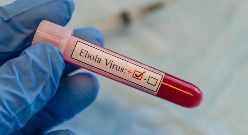 Megérkezett az ebola Európába: hivatalosan is igazolták a halálos fertőzést Franciaországban