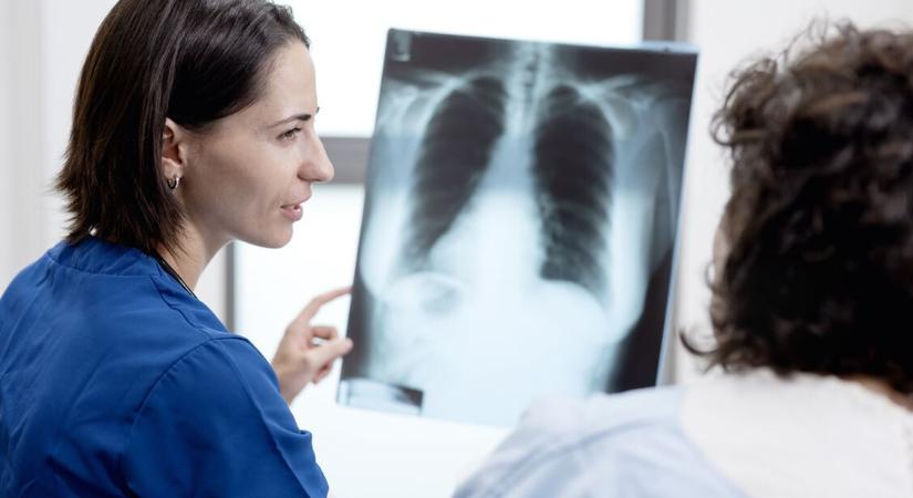 Reggel még nem tudta, hogy rákos, estére már meg is műtötték – Hihetetlen gyógyulástörténet