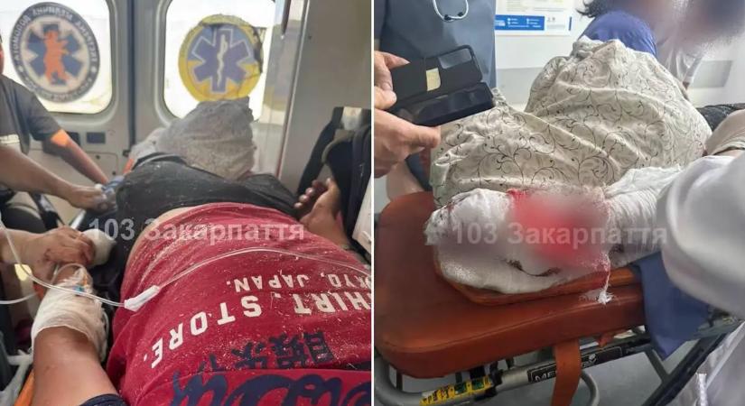 Súlyos baleset Kárpátalján: körfűrész csonkította meg a 17 éves fiút