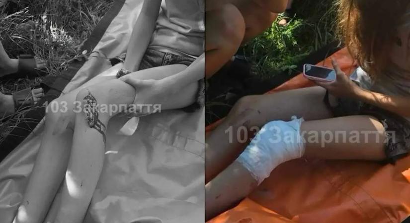 Súlyos baleset Munkácson: üvegre esett egy 12 éves kislány