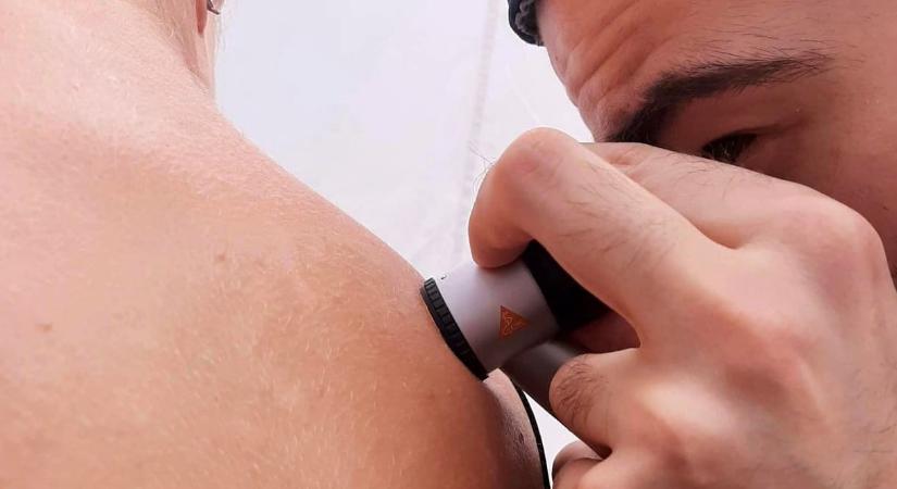 Találtak egy mérgező anyagot az Antarktisz mélyén, segíthet legyőzni a melanómát