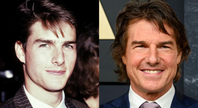 Tényleg a plasztikai műtétek miatt torzult el az arca? Akkor és most fotók, amik megmutatják, mennyit változott Tom Cruise az évek során