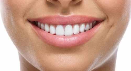 Teeth whitener at centre of controversy - Influencers obliged to post correction