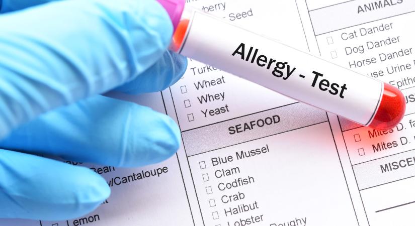 Tippek, hogy ne gyötörjön az allergia