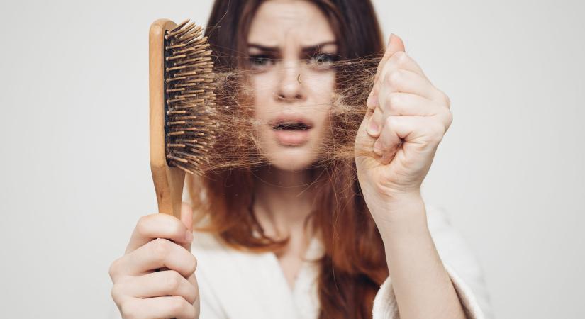 Hajhullás: nőknél a menopauza, a férfiaknál a magas tesztoszteronszint is ok lehet