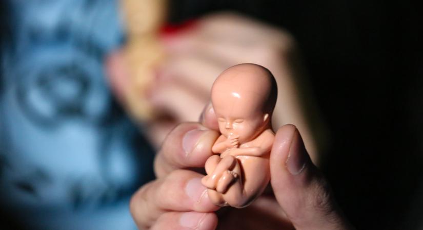 Az abortusz után életben maradt babák életéért folyik a harc